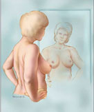 Breast Self-Examination - BBN